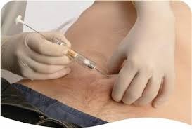 Se o médico prescreveu o tratamento com o medicamento Acetato de Gosserrelina (Zoladex), o paciente tem direito a ter acesso à medicação para seu tratamento.