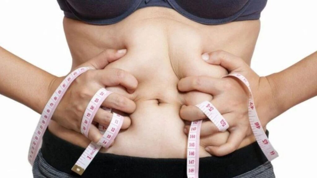 Havendo indicação médica, o plano de saúde deve cobrir a abdominoplastia.
