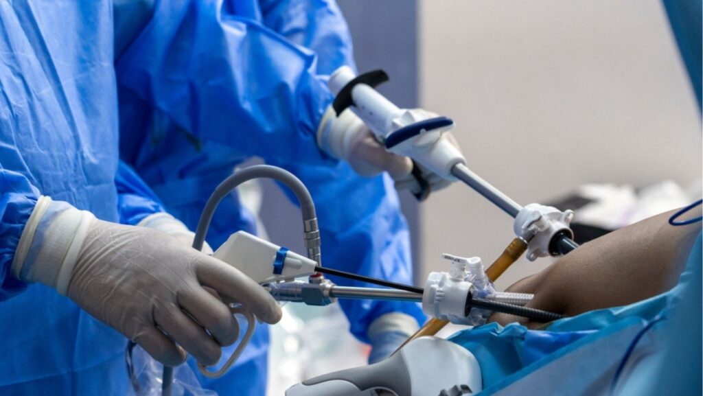 Havendo indicação médica, o plano de saúde deve cobrir a cirurgia bariátrica.