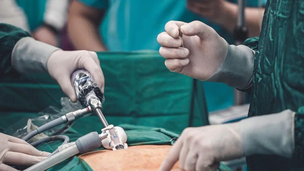 Havendo indicação médica, o plano de saúde deve cobrir a cirurgia bariátrica.