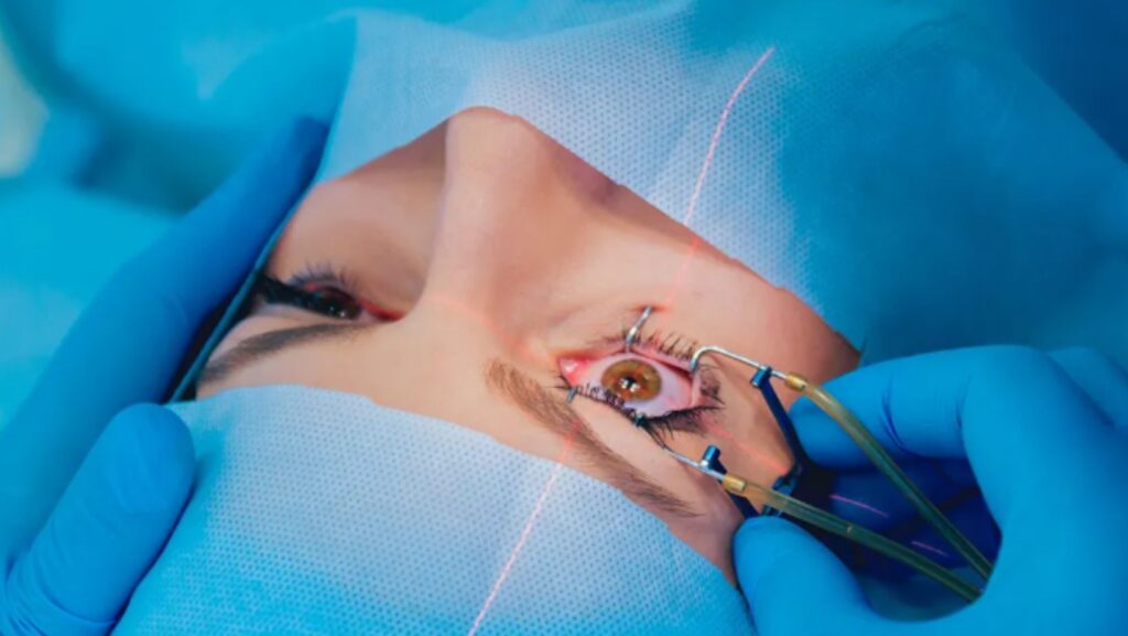 Havendo indicação médica, o plano de saúde deve cobrir a cirurgia refrativa.