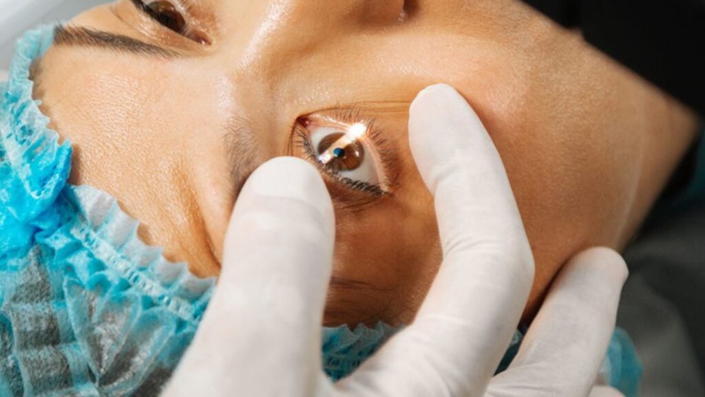 Havendo indicação médica, o plano de saúde deve cobrir a cirurgia refrativa.