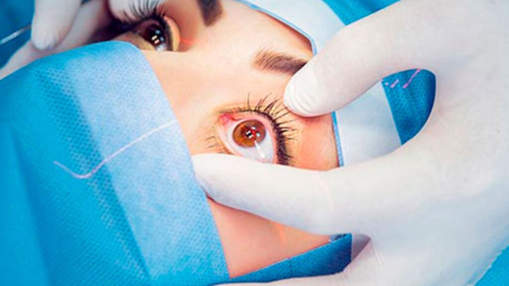 Havendo indicação médica, o plano de saúde deve cobrir a cirurgia refrativa.