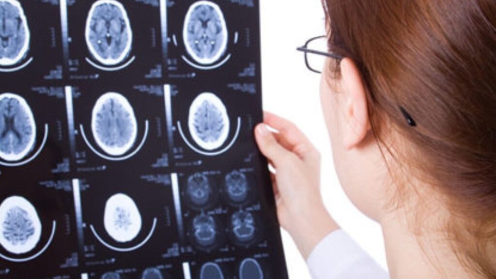 Havendo indicação médica, o plano de saúde deve cobrir o tratamento cirúrgico da epilepsia.