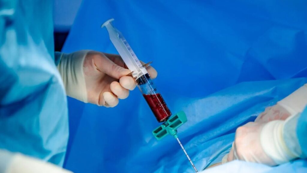 Havendo indicação médica, o plano de saúde deve cobrir o Transplante autólogo e o alogênico de medula óssea.