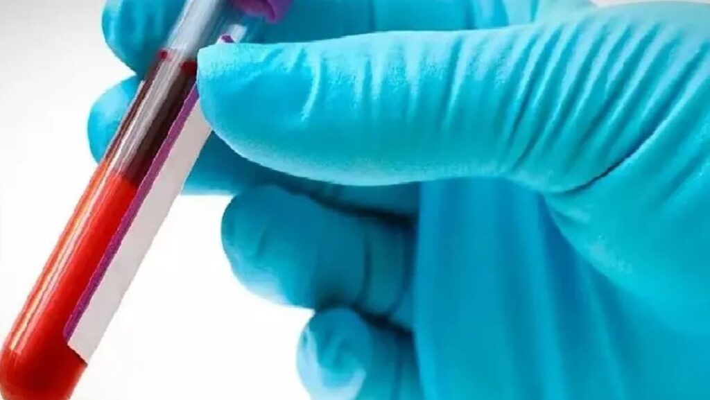 Havendo indicação médica, o plano de saúde deve cobrir o Transplante autólogo e o alogênico de medula óssea.