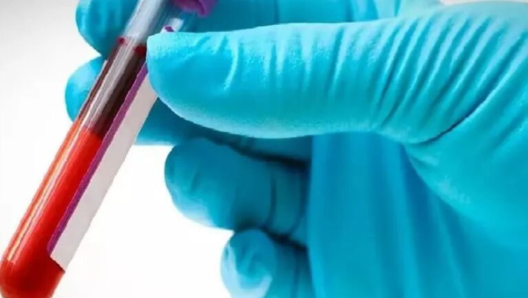 Havendo indicação médica, o plano de saúde deve cobrir o Transplante autólogo e o alogênico de medula óssea.