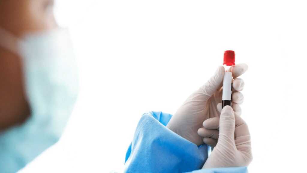 Havendo indicação médica, o plano de saúde deve cobrir o Transplante autólogo e o alogênico de medula óssea.