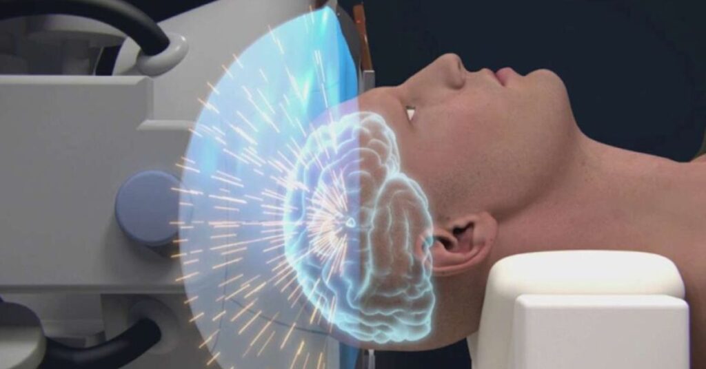 Havendo indicação médica, o plano de saúde pode negar os HIFU.